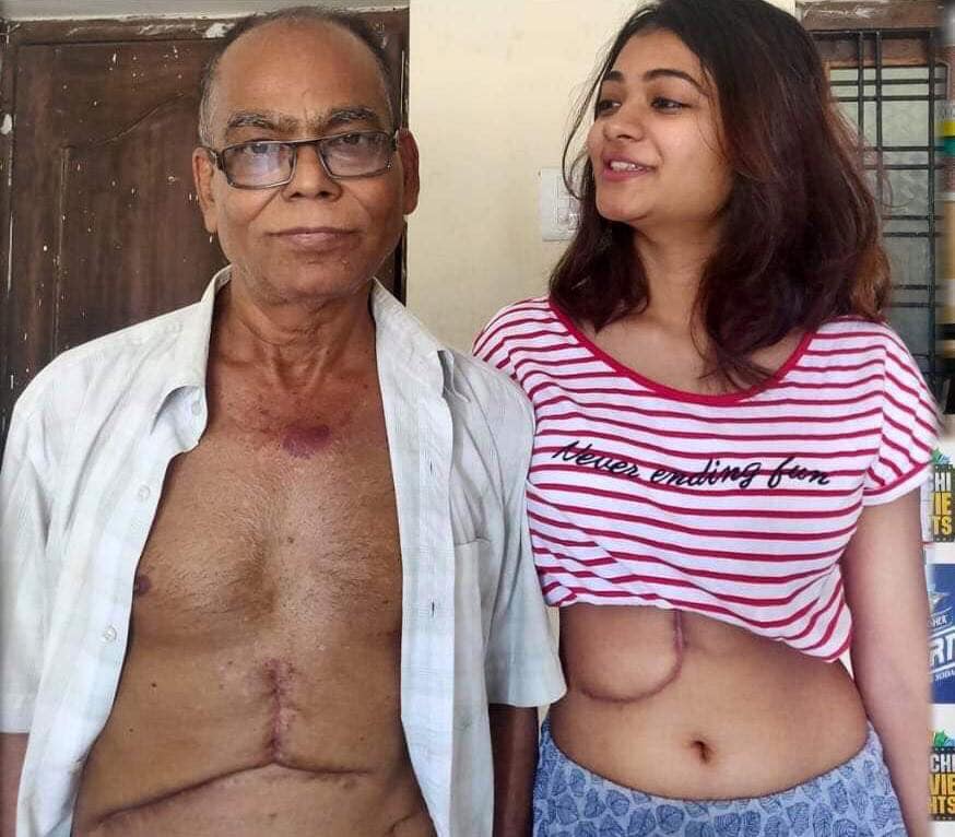 19 year old rekha dutta donated her liver to father