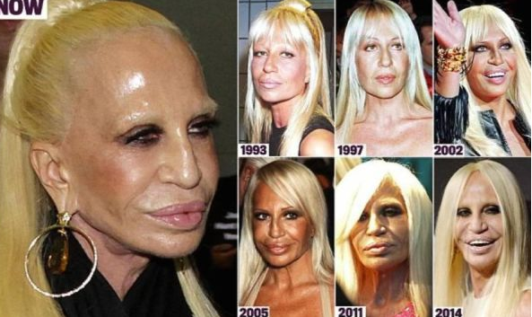 Worst Celebrities Plastic Surgeries Fails That Would Make You Think Twice Before Any
