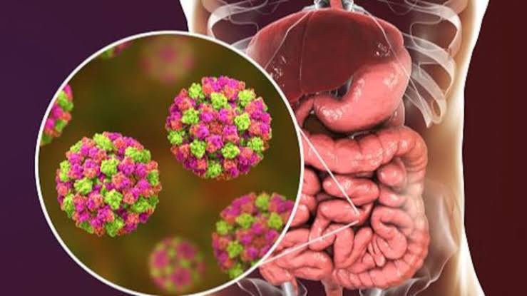 Gole par Norovirus ka danger!!! Know about this virus and it’s prevention here