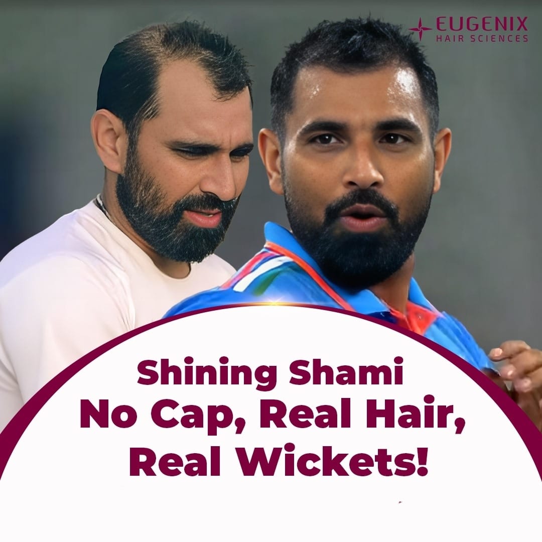 With new hairs on head, Mohammad Shami record breaking performance in world cup 2023